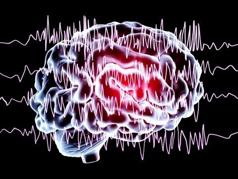 Эпилепсия: какие виды судорог существуют?