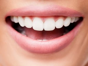 Эффективные способы отбеливания зубов в домашних условиях
