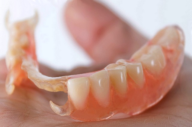 Правила по уходу за зубными протезами и имплантами